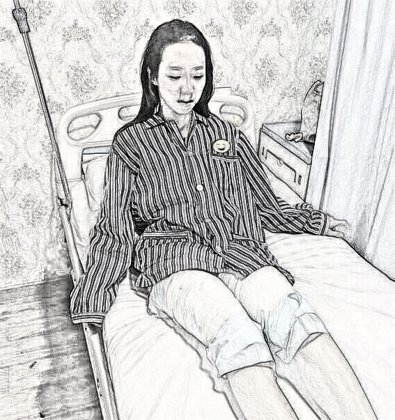 南京维多利亚刘光伟介绍 大腿吸脂60天前后图分享