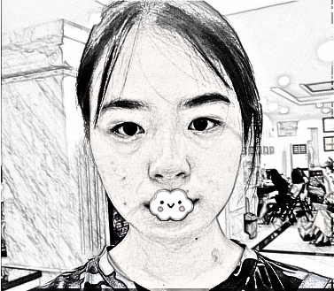 南京施尔美孙欣做双眼皮怎么样？60天果