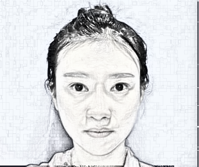 上海美联臣陈红梅做双眼皮怎么样呢?90天术后果