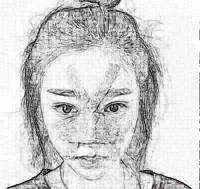 成都艾美薇医疗美容医院的隆鼻技术怎么样?介绍恢复果展示