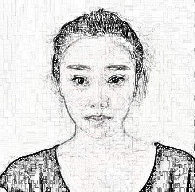 成都艾美薇医疗美容医院的隆鼻技术怎么样?介绍恢复果展示