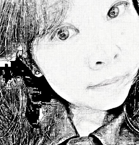 长沙美莱整形美容做的热玛吉，术后抗衰果分享