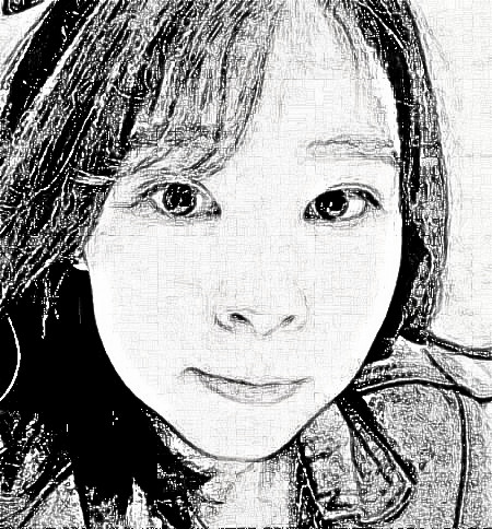 长沙美莱整形美容做的热玛吉，术后抗衰果分享