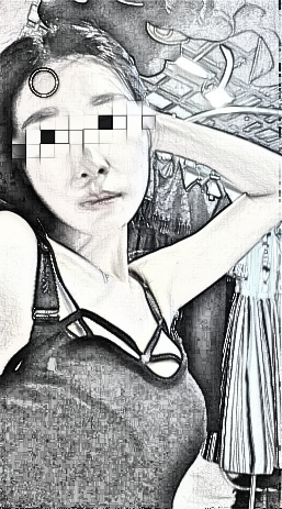 丰胸手术经历 美女恢复过程详述