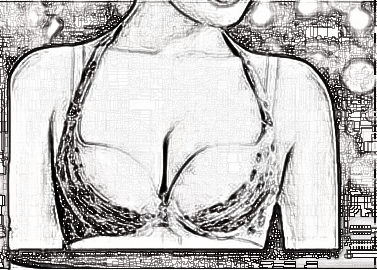 大连艺星整形医院乳房下垂矫正术的优势有哪些