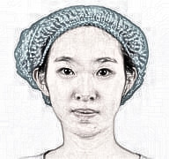 天津伊美尔整形美容眼部手术介绍分享！术后90天果