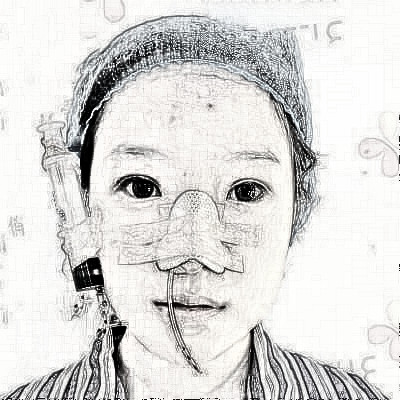 成都艺美汇美容医院鼻部手术,拥有小翘鼻不是梦