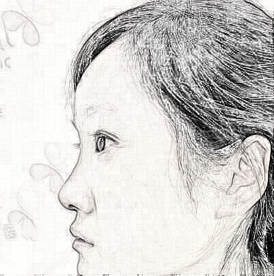 成都艺美汇美容医院鼻部手术,拥有小翘鼻不是梦
