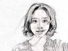 北京艺美医疗美容面部吸脂如何？我也可以拥有小V脸