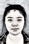 天津美莱做切开双眼皮的果怎么样？介绍展示