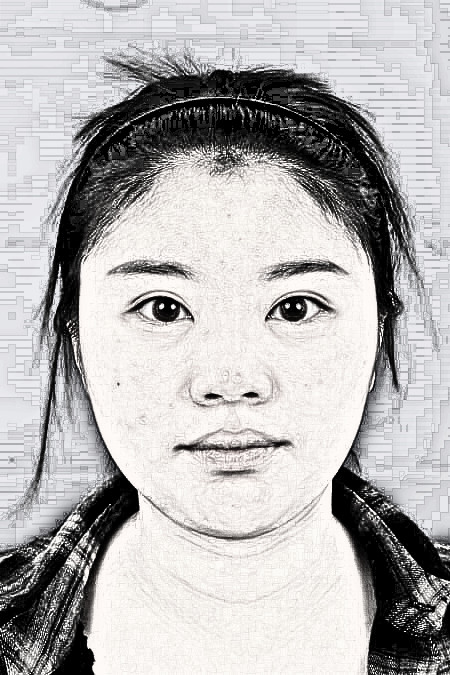 天津美莱做切开双眼皮的果怎么样？介绍展示