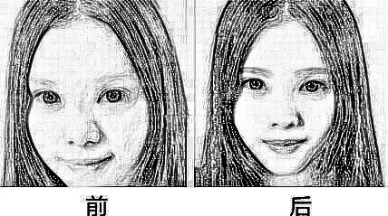 新疆艾美半长期纹唇 纹唇前你不可不知的十件事