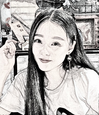 康华清医疗美容埋线提升介绍分享,术后72天分享