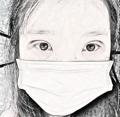 南方医科大学珠江医院做的双眼皮，介绍分享！