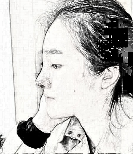 上海第九医院做了隆鼻后,我也是拥有小翘鼻的人啦