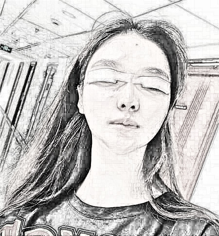 衡阳附二医院整形双眼皮介绍,闭眼微创很自然