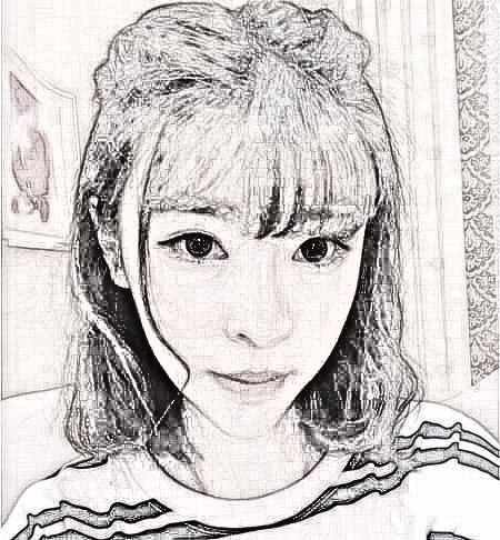 成都军大自体脂肪填充，术后100天分享