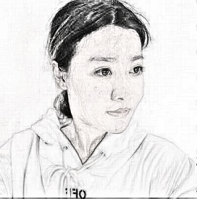 成都美莱自体脂肪面部填充果怎么样？介绍展示