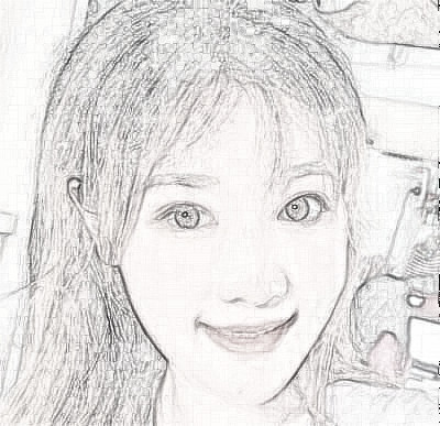 成都美莱自体脂肪面部填充果怎么样？介绍展示
