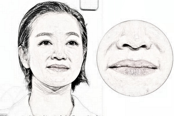 南京美立方面部除皱术为什么独领一格