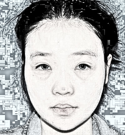 广州韩后整形医院鼻部手术整形果怎么样？好不好？介绍有吗
