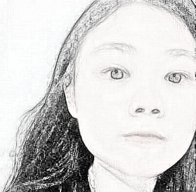 成都艾美薇医疗美容院面部提升项目果如何？介绍