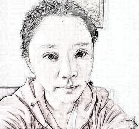 广州华美医疗美容医院自体脂肪面部填充果如何？介绍分享