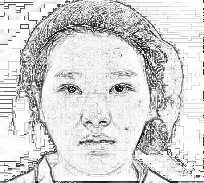 上海百d丽医疗美容门诊_鼻部手术_隆鼻_介绍分享|术后果