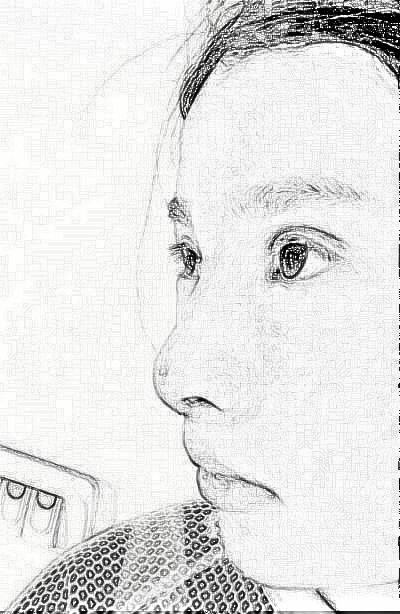 上海百d丽医疗美容门诊_鼻部手术_隆鼻_介绍分享|术后果