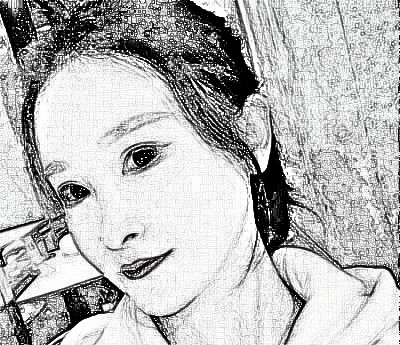 上海华美医疗美容医院V-LINE瓜子脸手术介绍分享