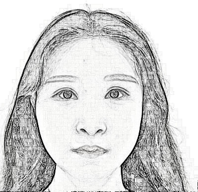 上海华美医疗美容医院V-LINE瓜子脸手术介绍分享