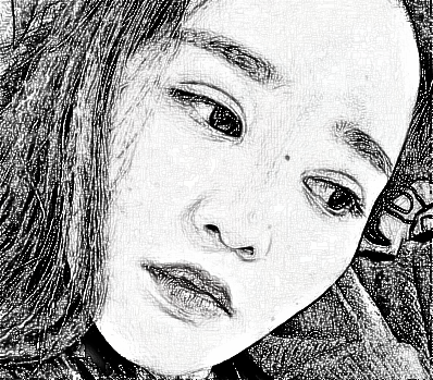 杭州格莱美张霞飞医师眼部综合、面部吸脂_介绍分享