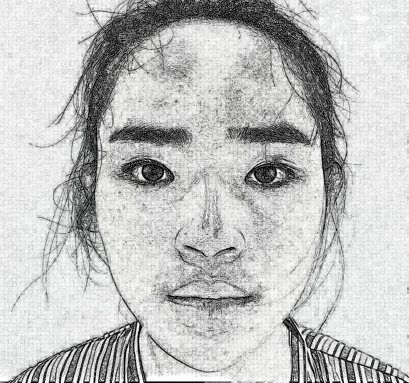 杭州格莱美金凤茹医师鼻部整形介绍 前后