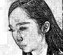 杭州格莱美熊滔医师隆鼻+注射瘦脸 介绍分享
