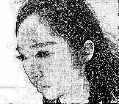 杭州格莱美熊滔医师隆鼻+注射瘦脸 介绍分享