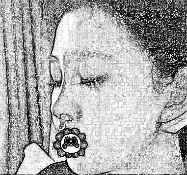 成都米兰魏家宾医师隆鼻介绍 前后
