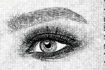 手术祛黑眼圈方法有哪些