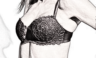 切除副乳多少钱 南宁米兰柏菲美容整形医院切副乳咋样？