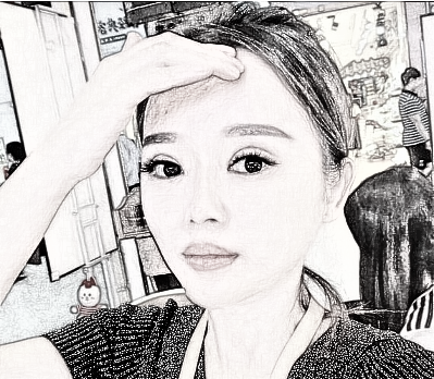 广州美恩许扬滨做的眼鼻部手术整形 术后90天果