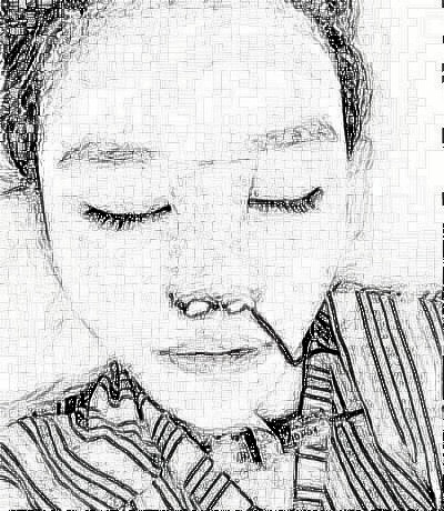 西安亚太李民臣做的鼻子 隆鼻介绍术后66天果分享