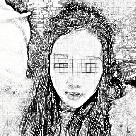 郑州丽天整形自体软骨垫鼻尖怎么样？果好！小翘鼻好好看！