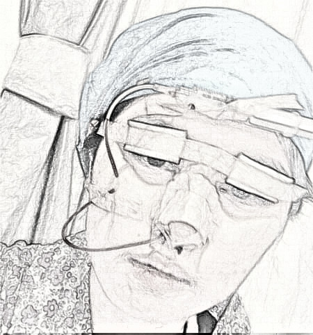 上海玫瑰医疗美容医院的眼部多项整形怎么样？果|医生|介绍