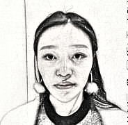 昆明艺星医疗美容医院鼻部手术介绍，术后100天分享