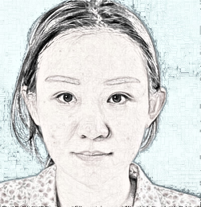 北京美莱医疗美容做鼻部手术果如何？隆鼻介绍术后100天分享
