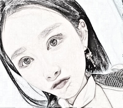 厦门华美找陈运生做的眼部手术怎么样？介绍分享