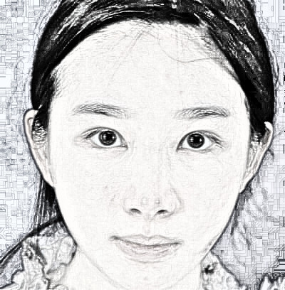 厦门华美找陈运生做的眼部手术怎么样？介绍分享