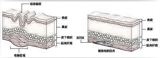 大概多少钱 常用除皱材料有哪些