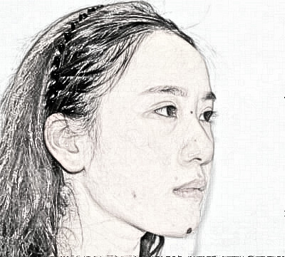 宁波薇琳医疗美容医院肋软骨隆鼻怎么样？术后两个月果分享