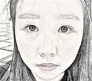 重庆时光整形做双眼皮怎么样?术后三个月介绍分享!