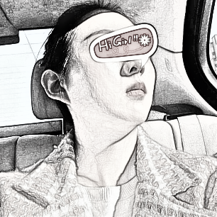 天津瑷珊整形医院做了硅胶垫下巴分享术后果分享,手术流出